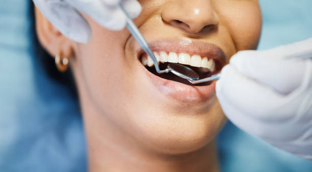 Best Broken or Chipped Tooth Repair in Edgewood, MD