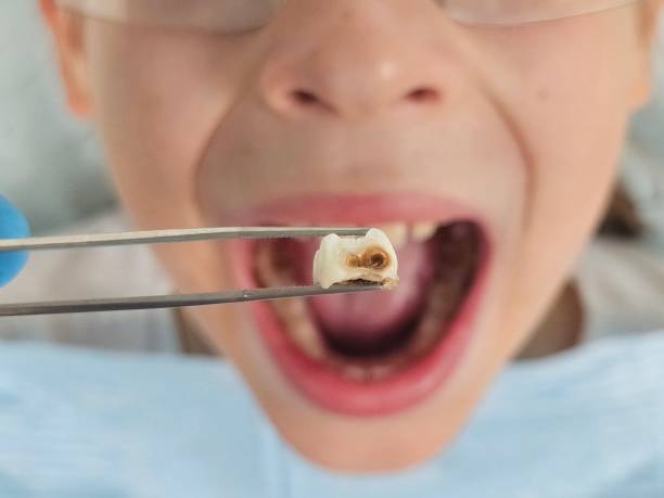 Best Emergency Pediatric Dental Care in Edgewood, MD